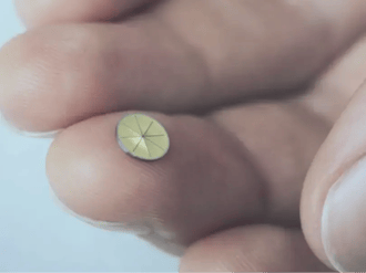Vibrosonic: A unique hearing solution